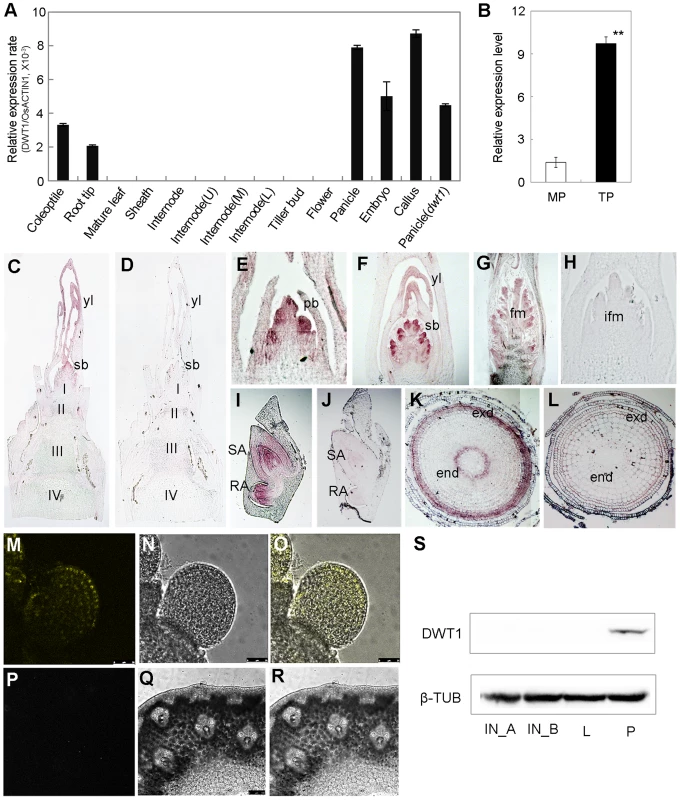 Expression pattern of DWT1 transcripts and proteins.