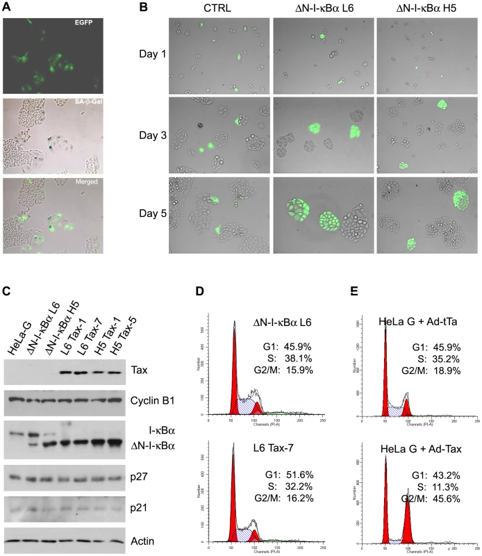ΔN-I-κBα prevents Tax-induced senescence.