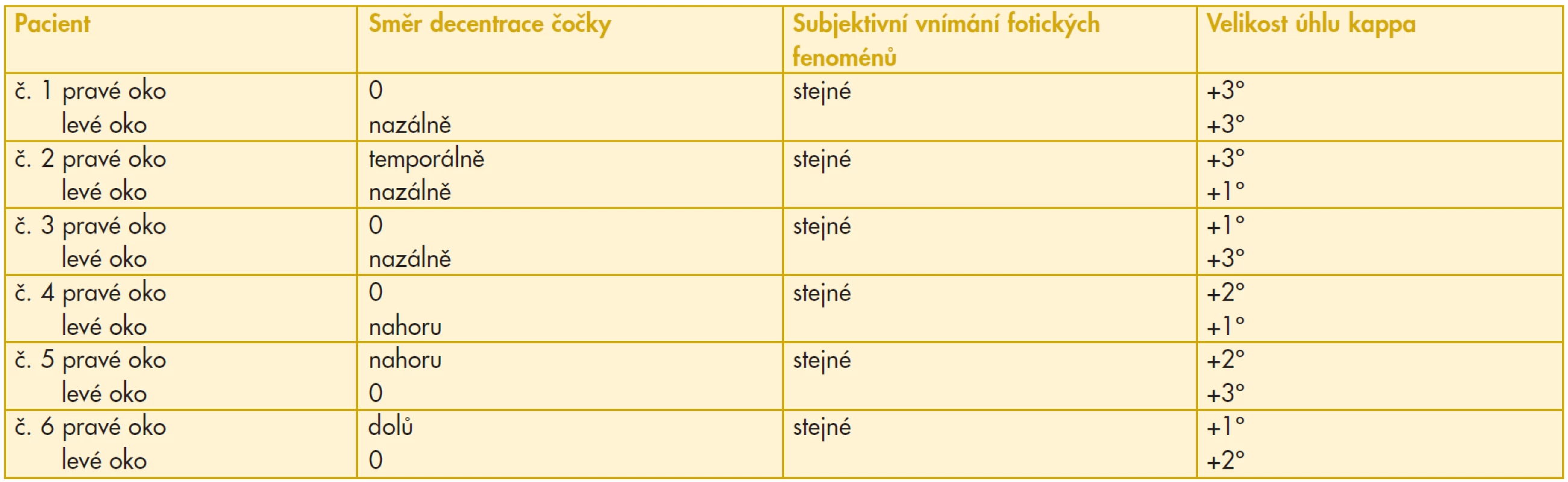 Údaje pacientů s decentrovanými čočkami, kteří nevnímali rozdílně fotické fenomény na pravém a levém oku ve vztahu k centraci čočky a velikosti
úhlu kappa