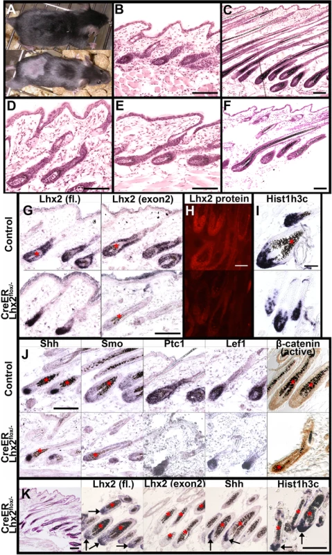 Lhx2 is required for anagen progression.