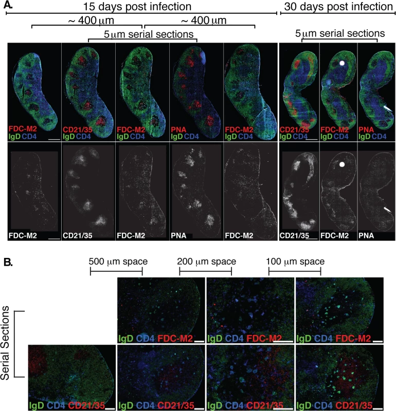 (A) Left Inguinal (Ing) LN from Bb-infected mice were analyzed by immunofluorescence for follicular dendritic cell markers FDC-M2, CD21/35, and for germinal centers (PNA; all red).