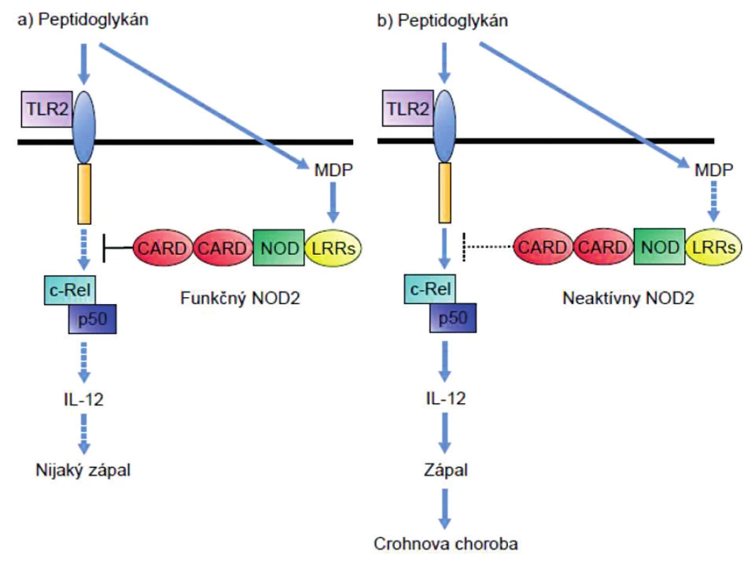 Vplyv mutácie NOD-2 na signalizáciu cez receptor TLR-2 
Peptidoglykánmi indukovaná signalizácia cez TLR2 vedie aktiváciou transkripčného faktora NF-κB (cRel – p50) k produkcii IL-12 a tým k polarizácii imunitnej odpovede do T<sub>H</sub>1-smeru. Signalizácia cez NOD-2, ktorý rozpoznáva muramyldipeptid, inhibuje signalizáciu cez TLR2 (ľavá časť obrázku). Pri mutácii génu
NOD-2 dochádza k výpadku negatívnej kontroly aktivity TLR2 a tým premrštenej aktivácii T<sub>H</sub>1-imunitnej odpovede (pravá časť obrázku).
Figure 1. Effect of the NOD-2 mutation on signalling through the TLR-2 receptor
Peptidoglycan induced signalling through TLR2 leads to activation of the transcription factor, NF-κB (cRel – p50), and consequently to the production of IL-12, thus polarizing the immune response toward the T<sub>H</sub>1 direction. Signalling through NOD-2, which recognizes muramyl dipeptide, inhibits signalling through TLR2
(see the left part of the picture). Mutation of the NOD-2 gene results in the lack of negative control of TLR2 activity and thus in an enhanced activation of the T<sub>H</sub>1 immune response (see the right part of the picture).