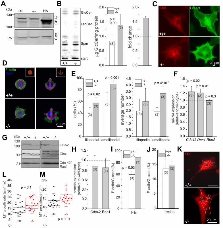 Dermal fibroblasts from GBA2 knockout-mice also display cytoskeletal defects.
