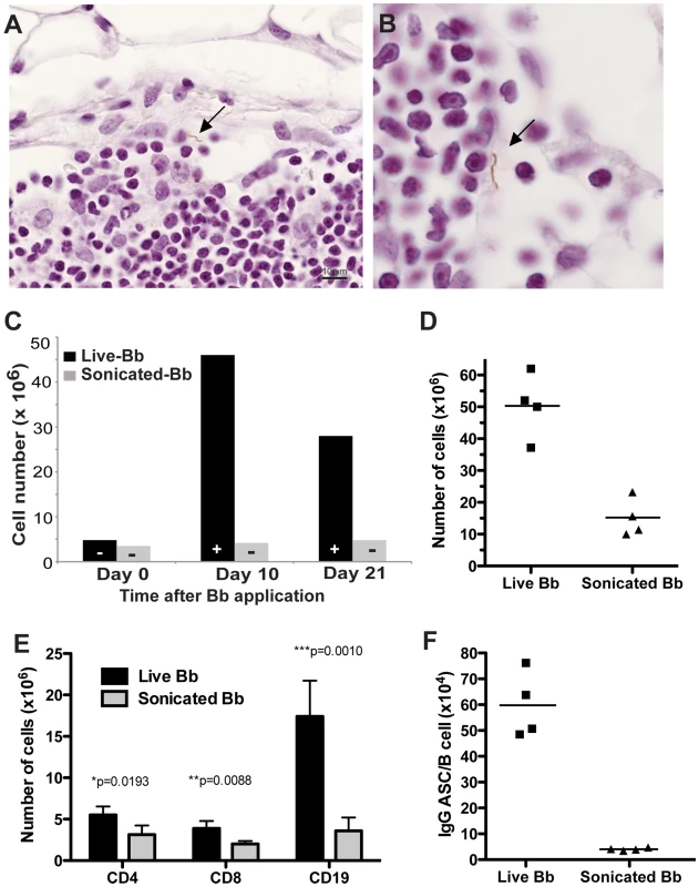 <i>B. burgdorferi</i> localizes to the subcapsular sinus of lymph nodes.