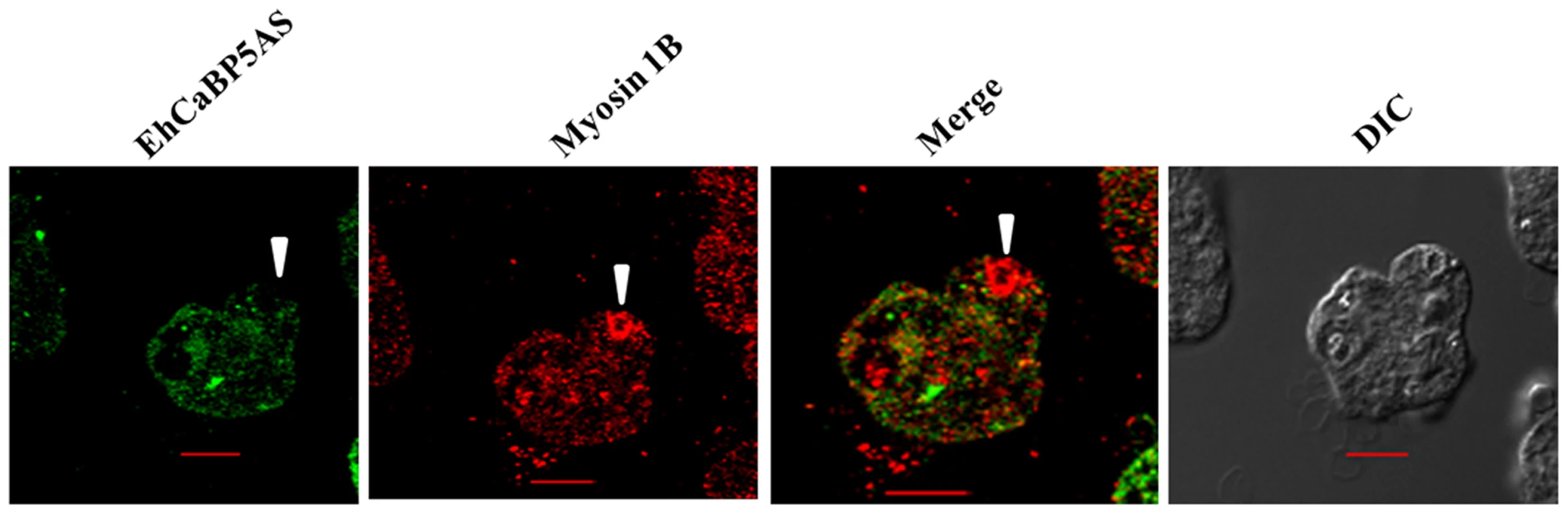 Erythrophagocytosis of amoebic cells overexpressing EhCaBP5 antisense RNA in presence of tetracycline.