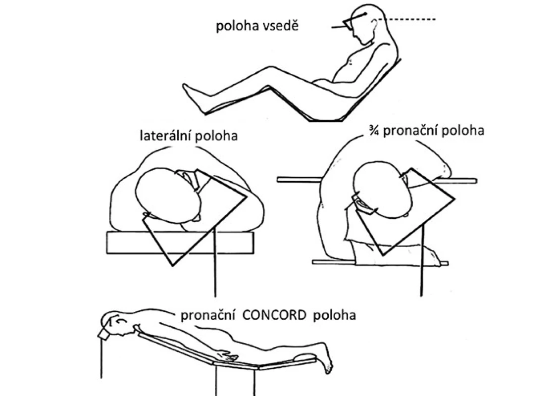Operační polohy používané při operacích pineální krajiny.
