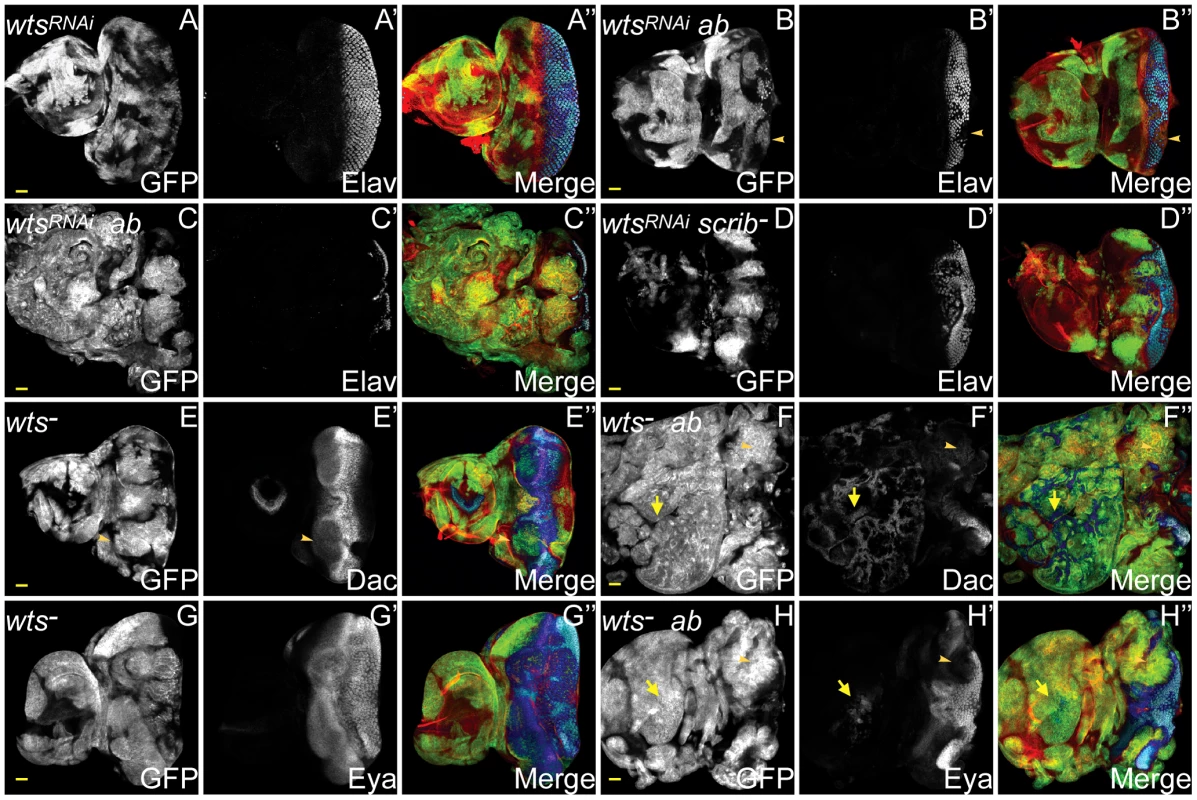 <i>ab</i> cooperates with impaired Hippo pathway signalling to drive tumour overgrowth.
