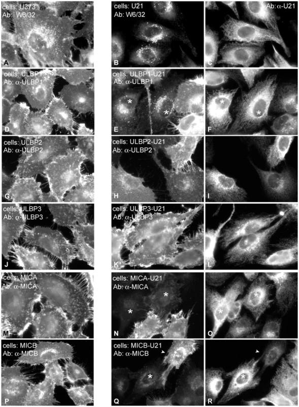 U21 reroutes ULBP1 and MICB to a punctate perinuclear compartment.