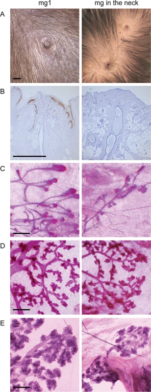 Supernumerary mammary gland in the neck consists of a nipple and a small ductal tree in <i>K14-Eda</i> mice.