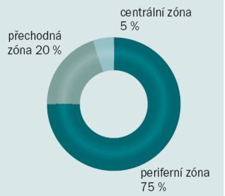 Výskyt karcinomu prostaty v jednotlivých zónách.