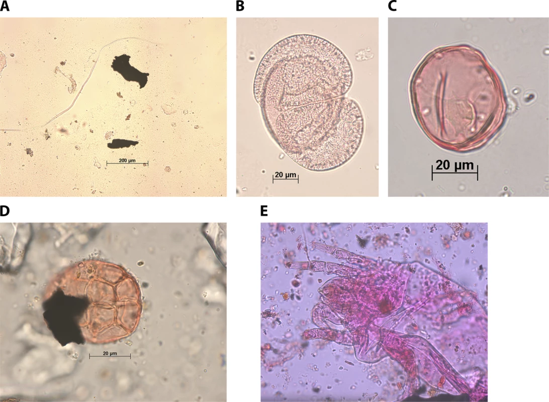 Photomicrographs of Material Found in Fake Artesunate Tablets