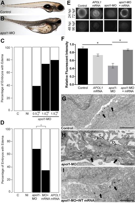 <i>apol1</i> morphant zebrafish embryos display generalized edema and glomerular filtration defects indicative of nephropathy.