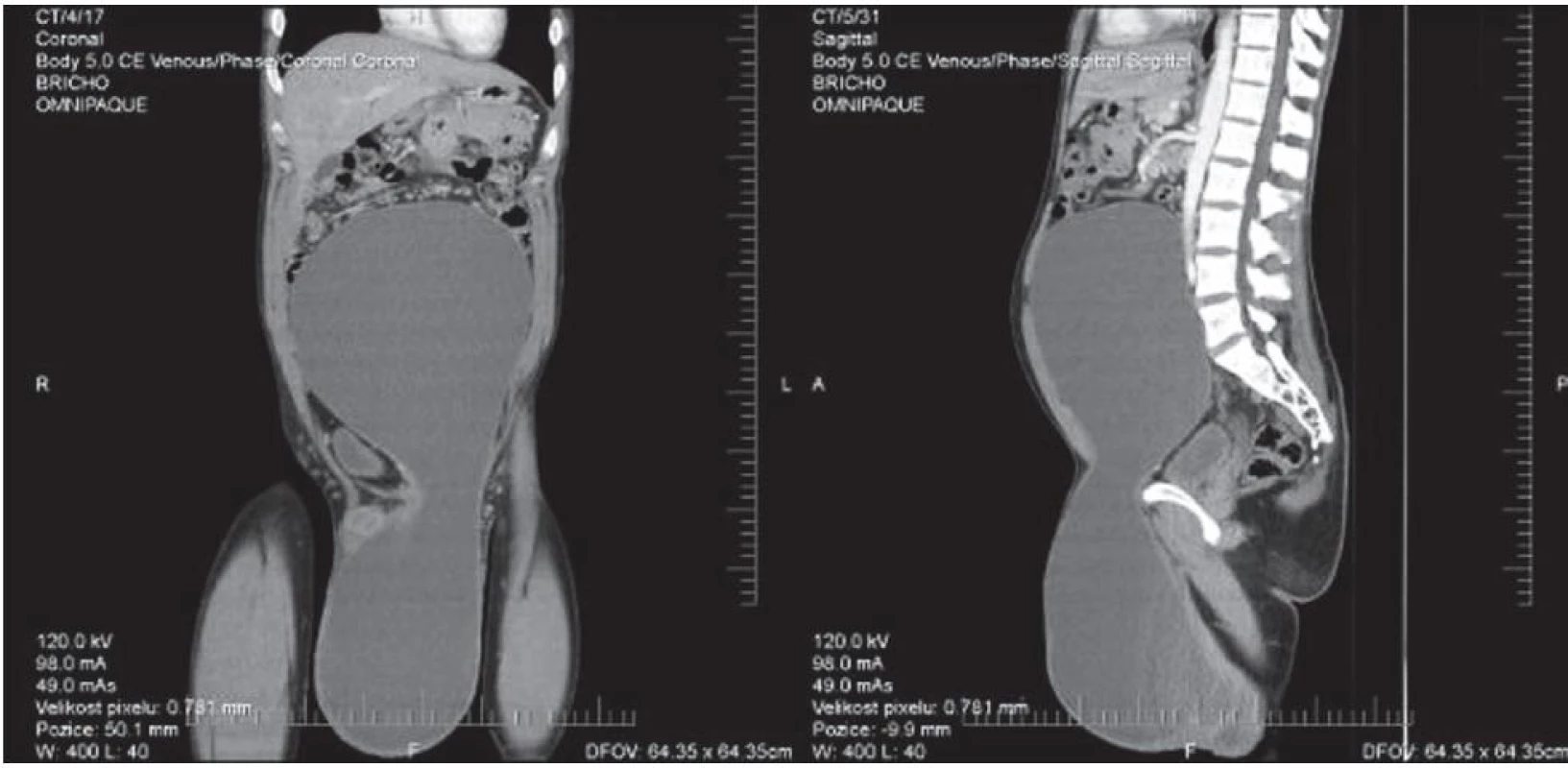 CT snímky před operací
Obr. 2. CT images before the operation