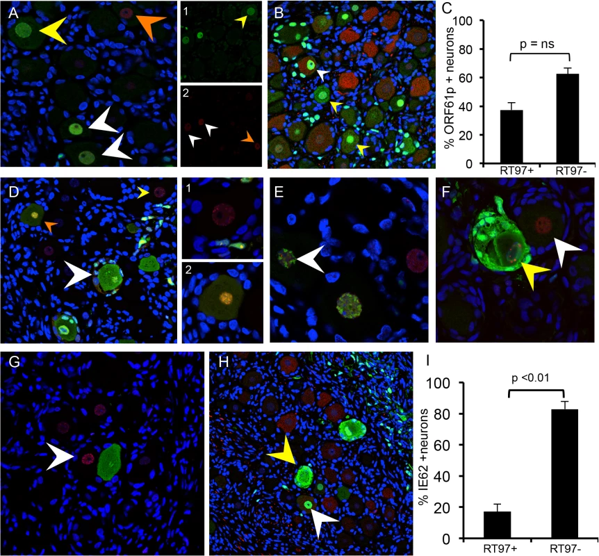 Restriction of VZV replication in mechanoreceptive neurons is associated with restricted IE62 expression.