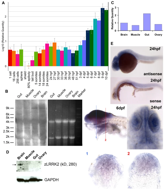 Expression profiling of <i>lrrk2</i> in zebrafish.