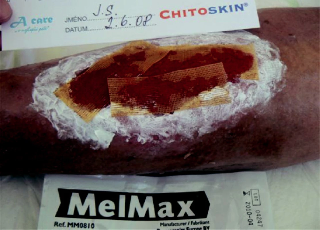 Rána s MelMaxem