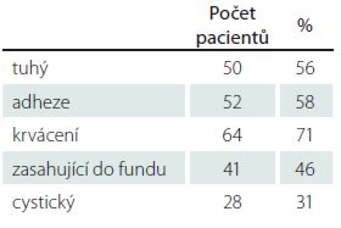Vlastnosti nádoru.