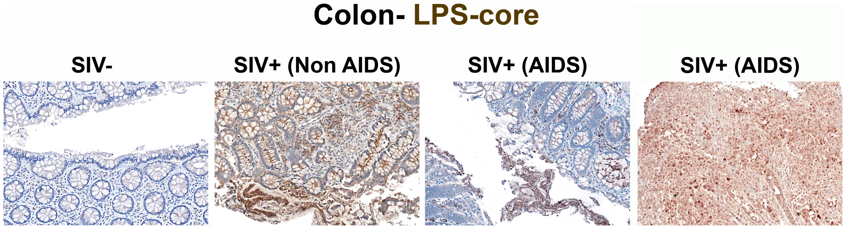 Identification of microbial translocation in large bowel of chronically SIV<sup>+</sup> RMs.