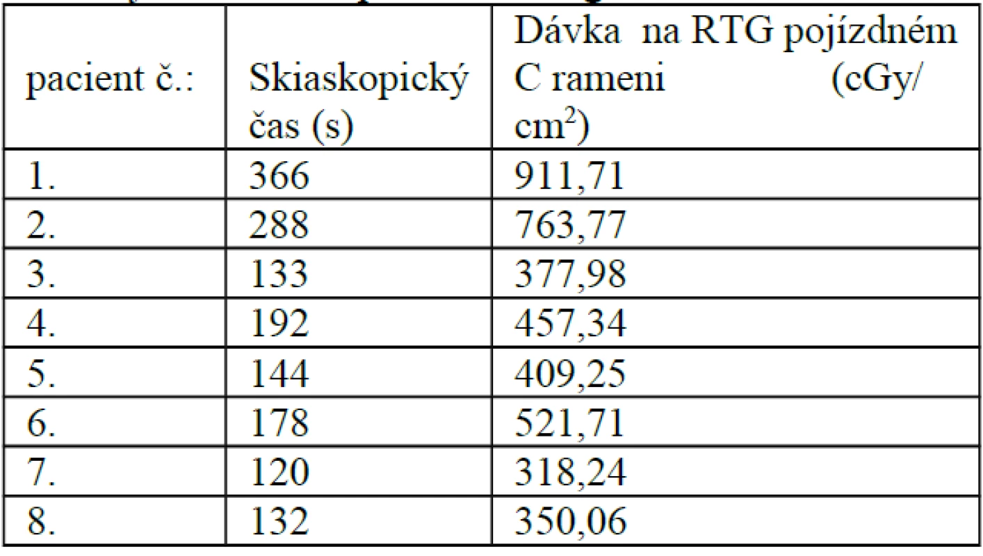 Osteosyntéza UFN pomocí navigace