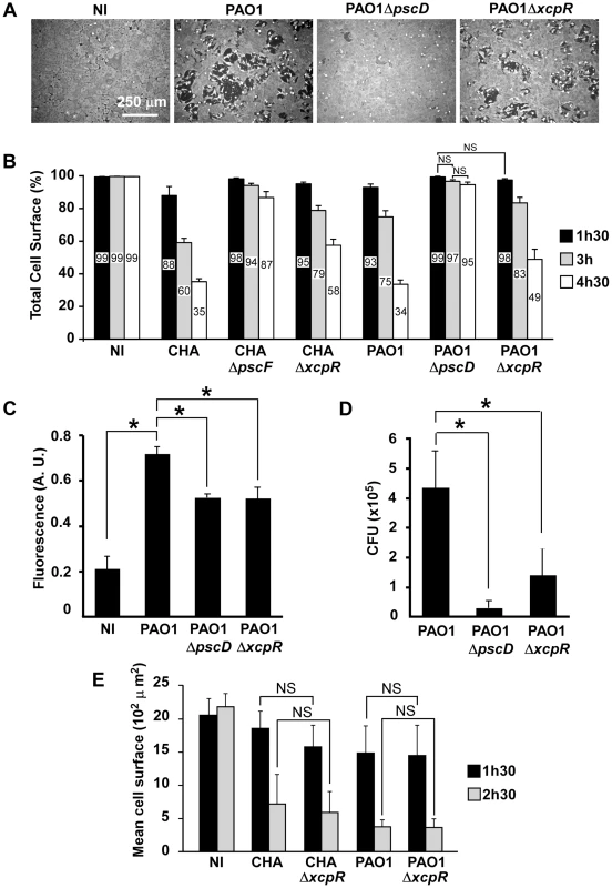 T3SS-induced cell retraction is influenced by T2SS.
