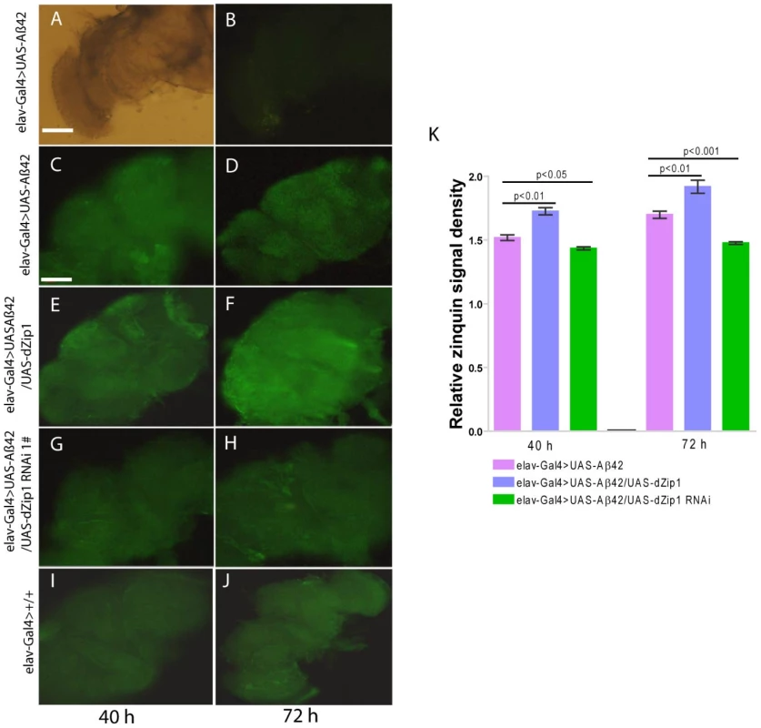 <i>dZip1</i> overexpression results in Zn accumulation in Aβ42-expressing fly brains revealed by Zinquin staining.
