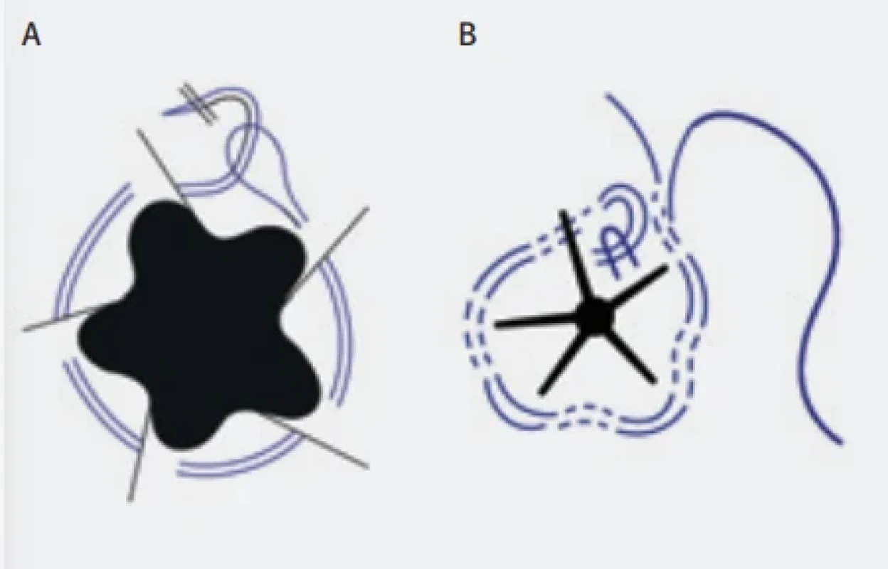  / Fig. 3.