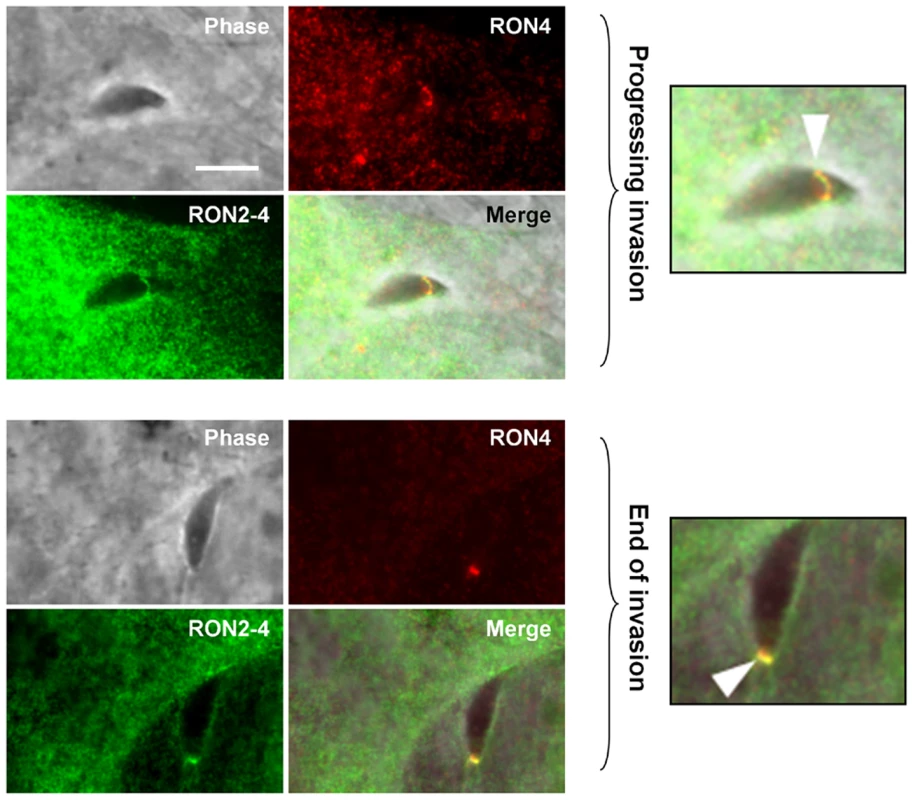 TgRON2 exposes at least one segment on the cytosolic side of the host cell plasma membrane.