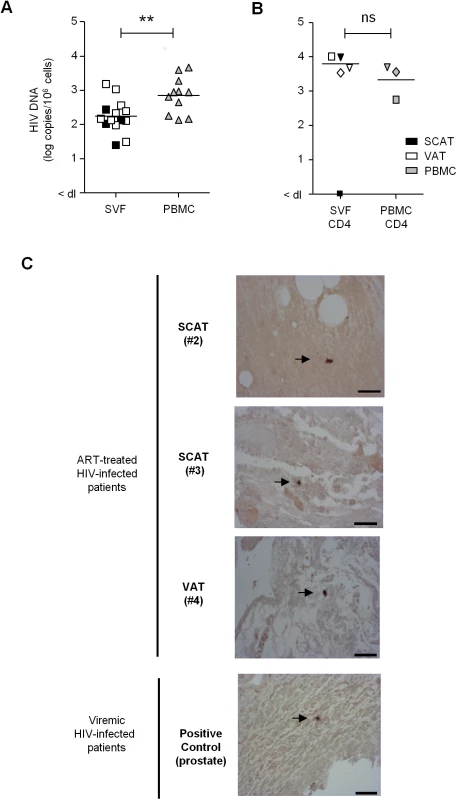 Detection of HIV DNA and RNA in adipose tissue.