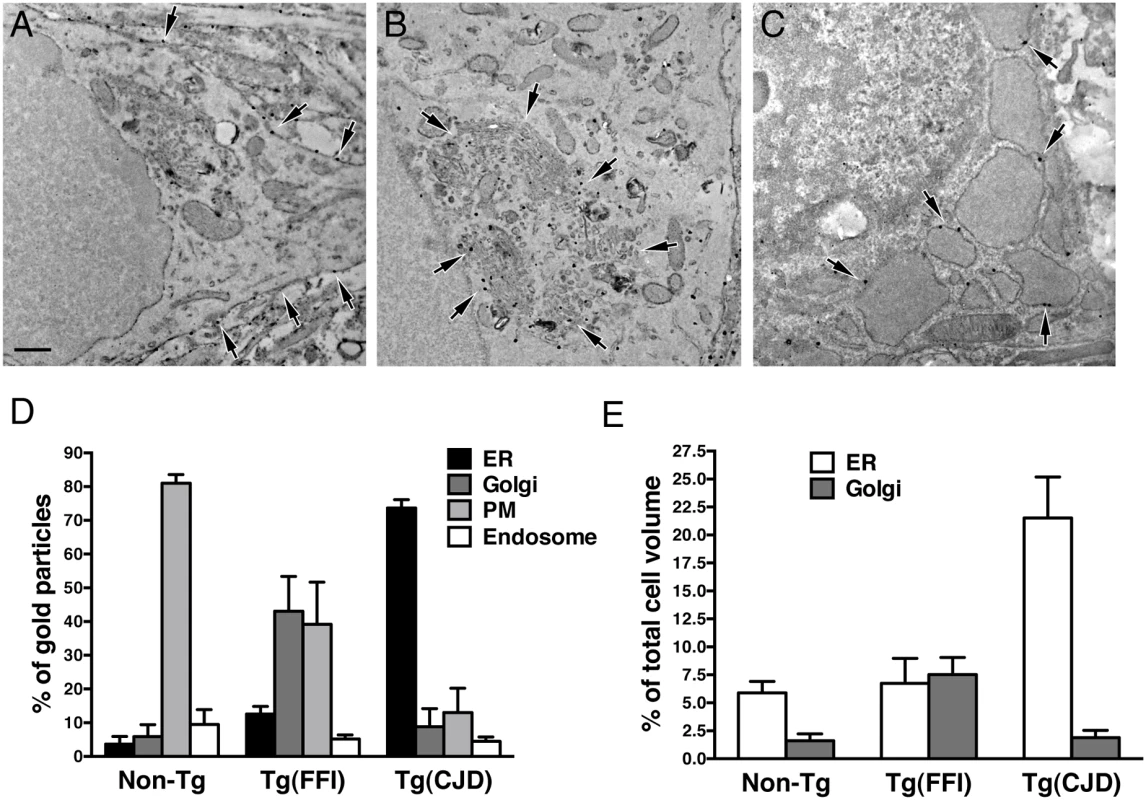 Tg(FFI) and Tg(CJD) neurons show different intracellular PrP accumulations and morphological abnormalities of transport organelles.