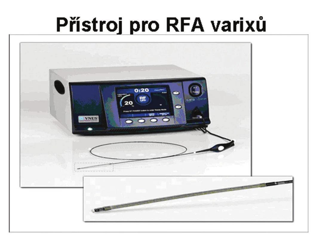 Přístroj pro RFA varixů
Fig. 1. RFA apparatus