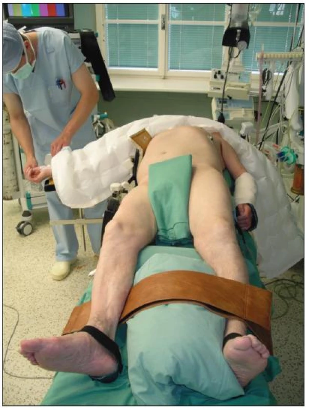 Poloha pacienta
Fig. 3. Positioning of patient