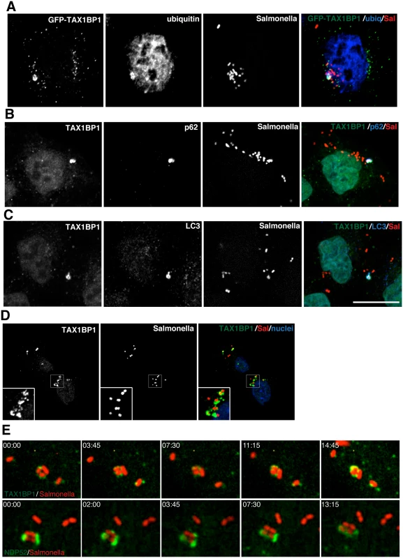 TAX1BP1 localises to Salmonella that have escaped into the cytosol of infected cells.