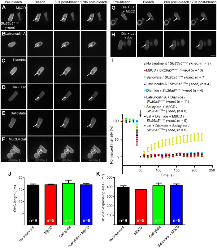 Slc26a5 mobility analysis in the lateral wall of isolated OHCs at P18-22.