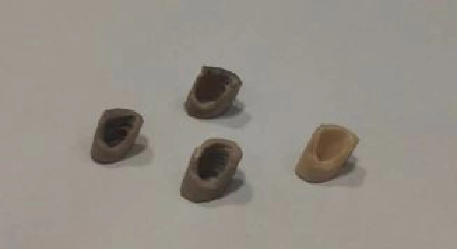 Resulting implants.