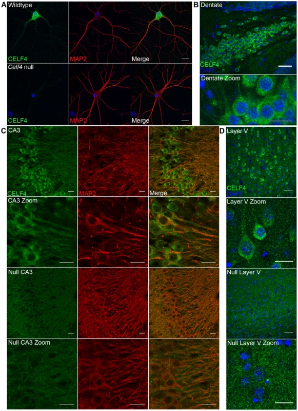 CELF4 protein is localized in soma and in neuronal projections.