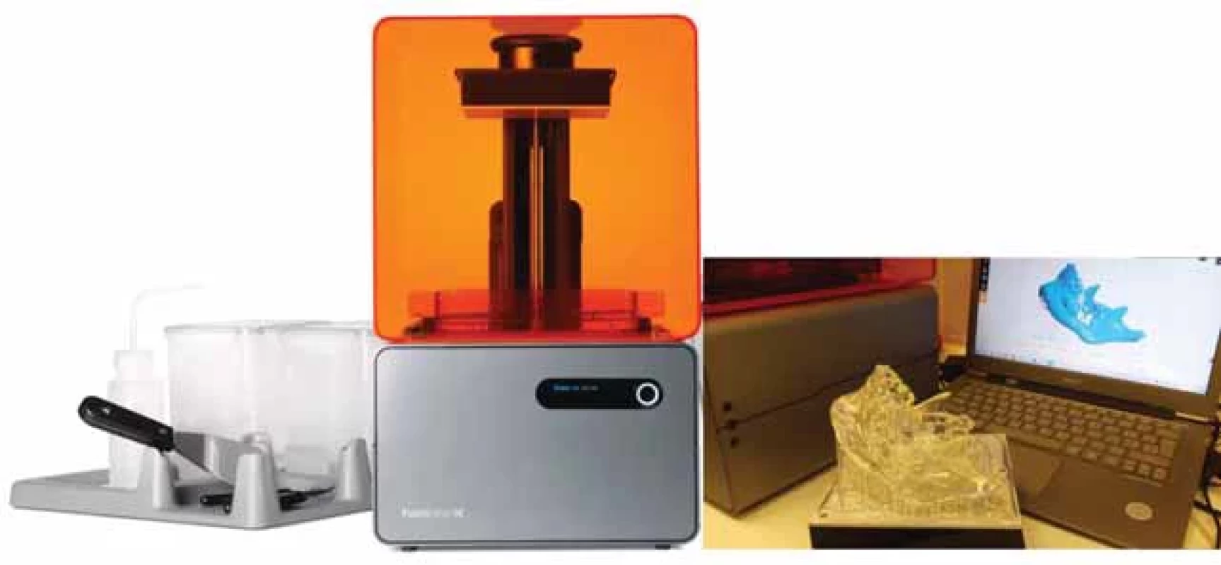 Formlabs Form 1+, a DLP printer; behind the laptop running the PreForm® SW and printed 3D mandible in front.