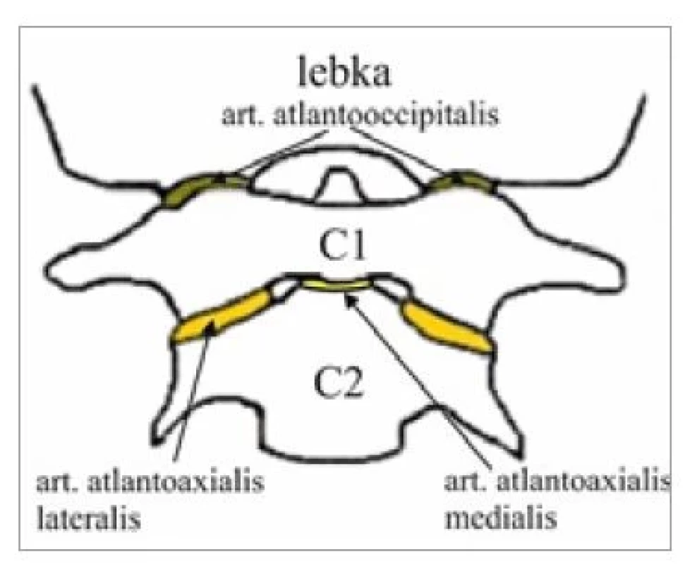Suboccipitálne väzy a membrány
(zdroj: autori).<br>
Fig. 3. Suboccipital ligaments and
membranes (source: authors).