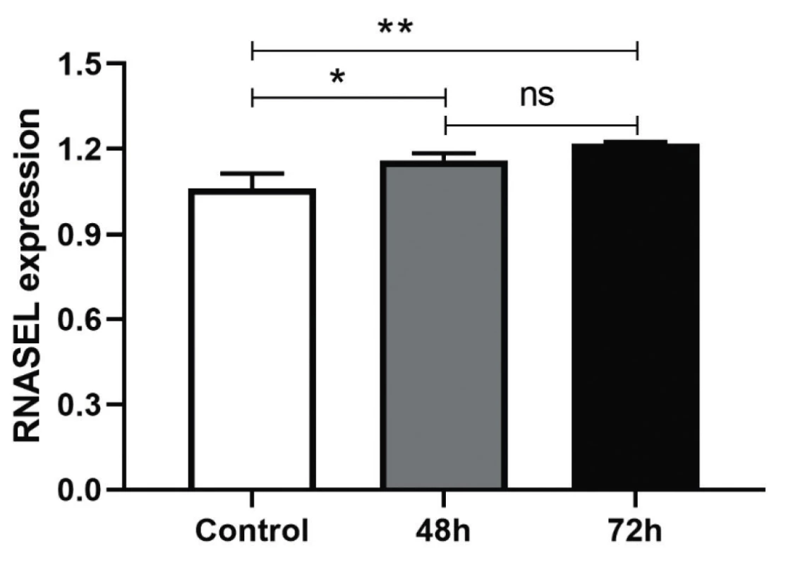 HEK-293T cells were transfected with AD-1 and
AD-2 and expression level of RNase L was quantified 48/72 h
posttransfection and normalized with internal control, HPRT
The expression level of RNase L was significantly different in
compared to the scrambled control at 48 h (*P < 0.0155) and
72 h (**P < 0.0045). The values are expressed as Mean ± SD.
Three repetitions were performed for each experiment.