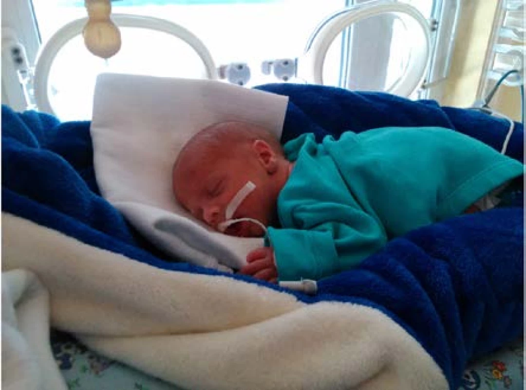 Zdravý novorozenec matky s exstrofií měchýře po jeho střevní augmentaci<br>
Fig. 4. A healthy newborn of the mother with bladder exstrophy after its intestinal augmentation
(Fotografie novorozence uveřejněna se souhlasem matky.)