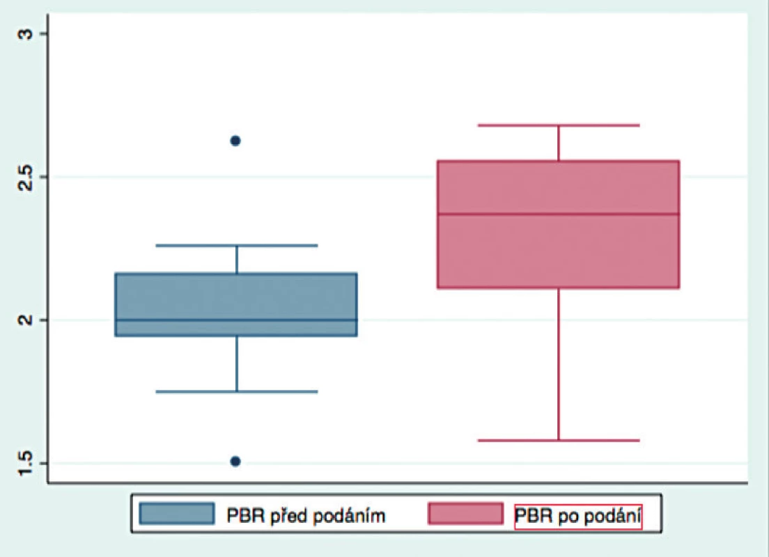 PBR hodnoty před podáním a po podání tekutiny
PBR – perfused boundary region