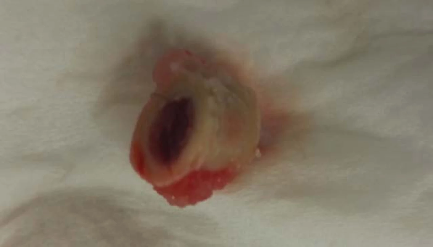 A part of the femur.