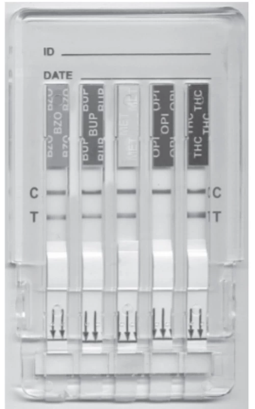 Orientational estimation of opiates in urine of the patient, caused by poppy seed ingestion