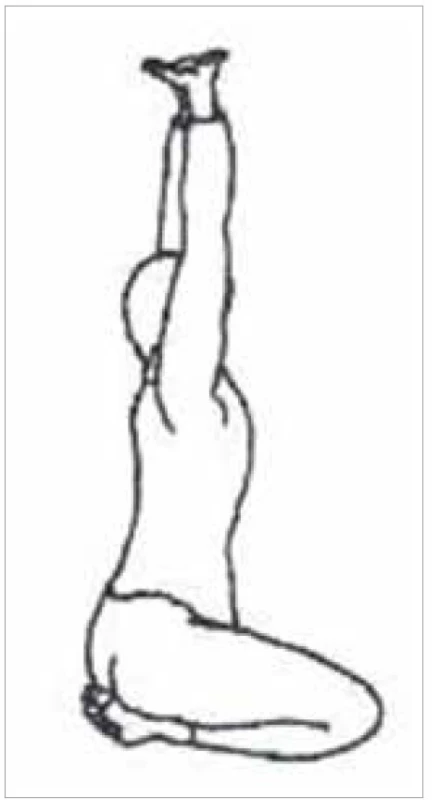 Cvik pre meridián žalúdka<br>
Fig. 6. Exercise for the stomach
meridian
