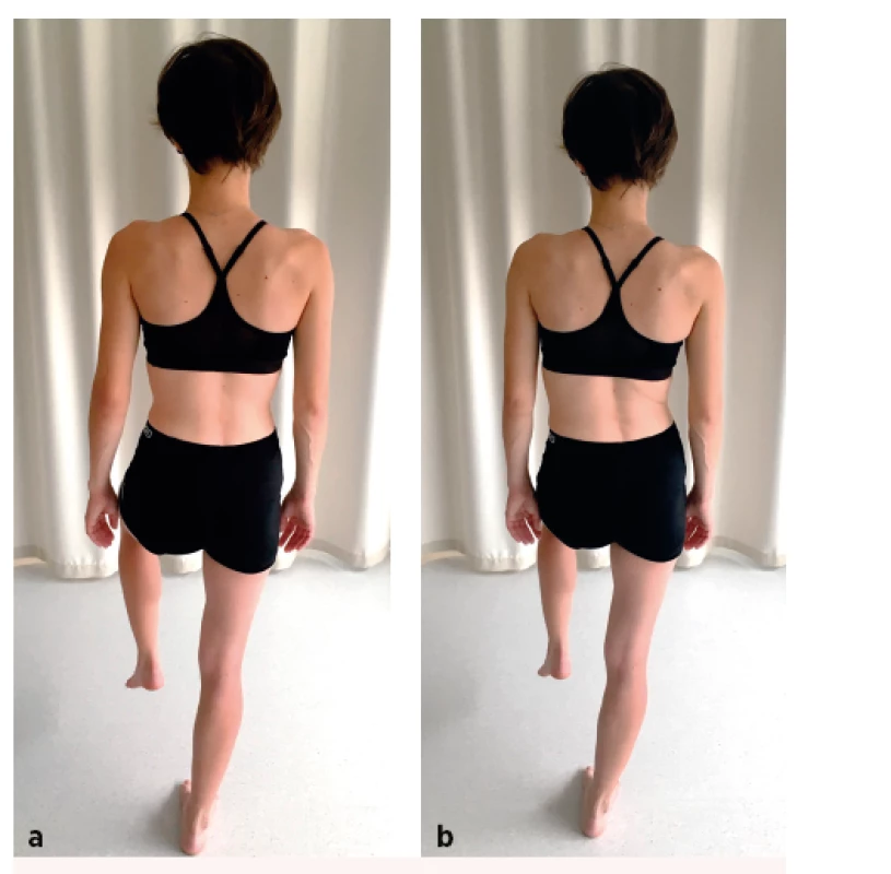 One leg stance test