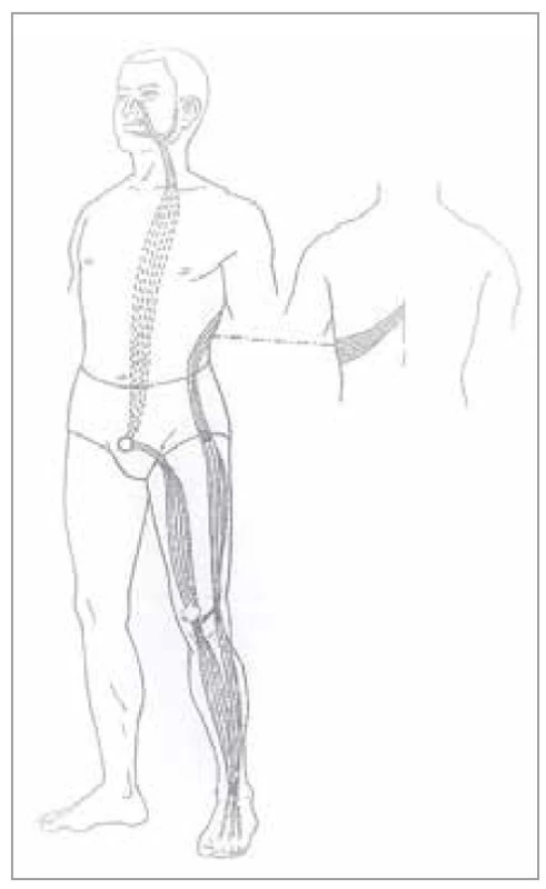 Šľachovo-svalová dráha žalúdka<br>
Fig. 5. Tendon-muscle path of the stomach