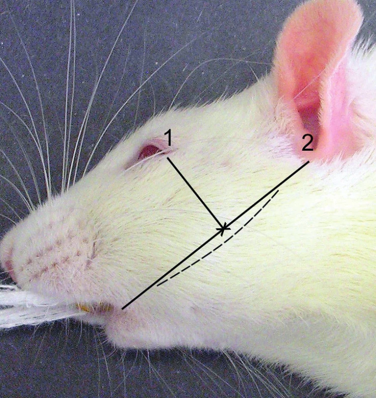 Bone prominence identification scheme. 1 – line from
the corner of the mouth to the lower edge of the external
acoustic meatus; 2 – perpendicular line from the external corner
of the eye to line 1. The cross indicates the point of muscle
dissection and approach to the bone prominence. The course of
the incision is indicated using the dashed line.<br>
(Author’s archive)