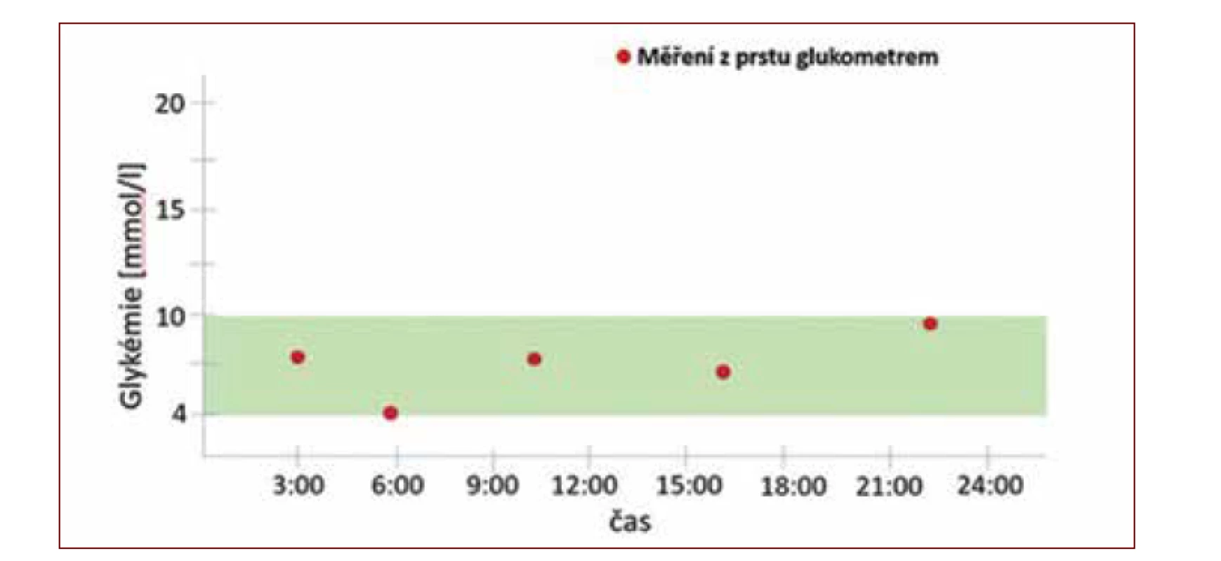 Glykemický profil vytvořený ze změřených glykemií z kapilární krve pomocí osobního
glukometru