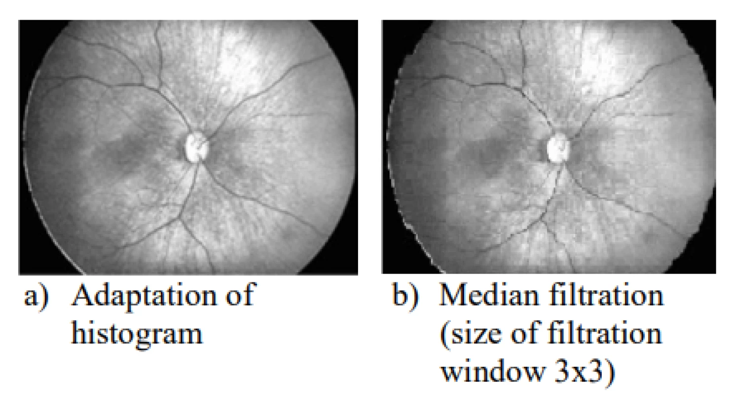 Second part of preprocessing image: a) the
adaption of histogram, b) median filtration with size of
filtration window 3×3.