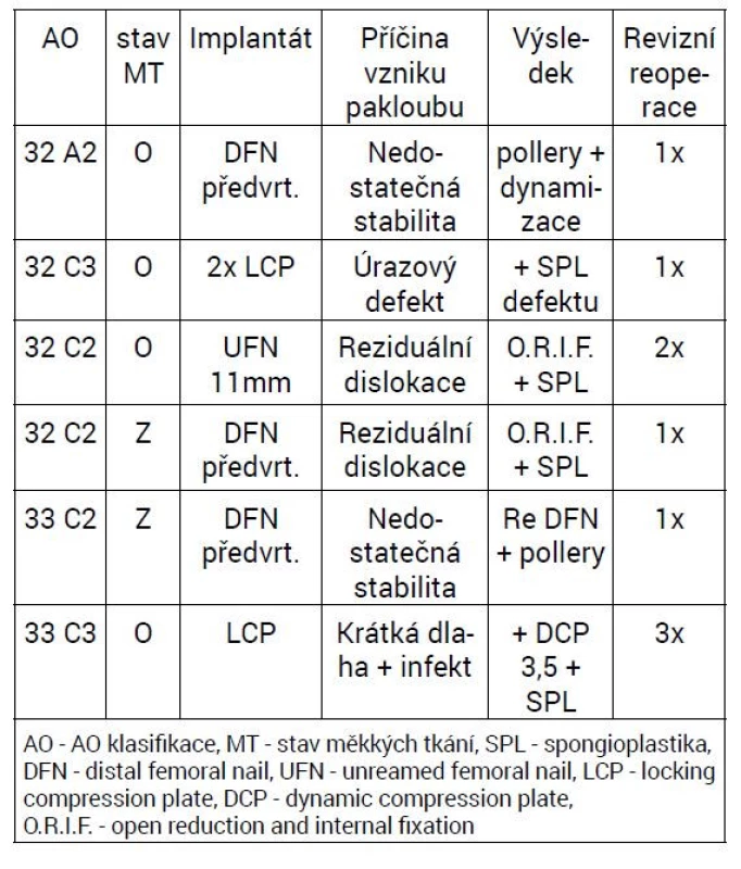 Příčina vzniku pakloubu a jejich řešení