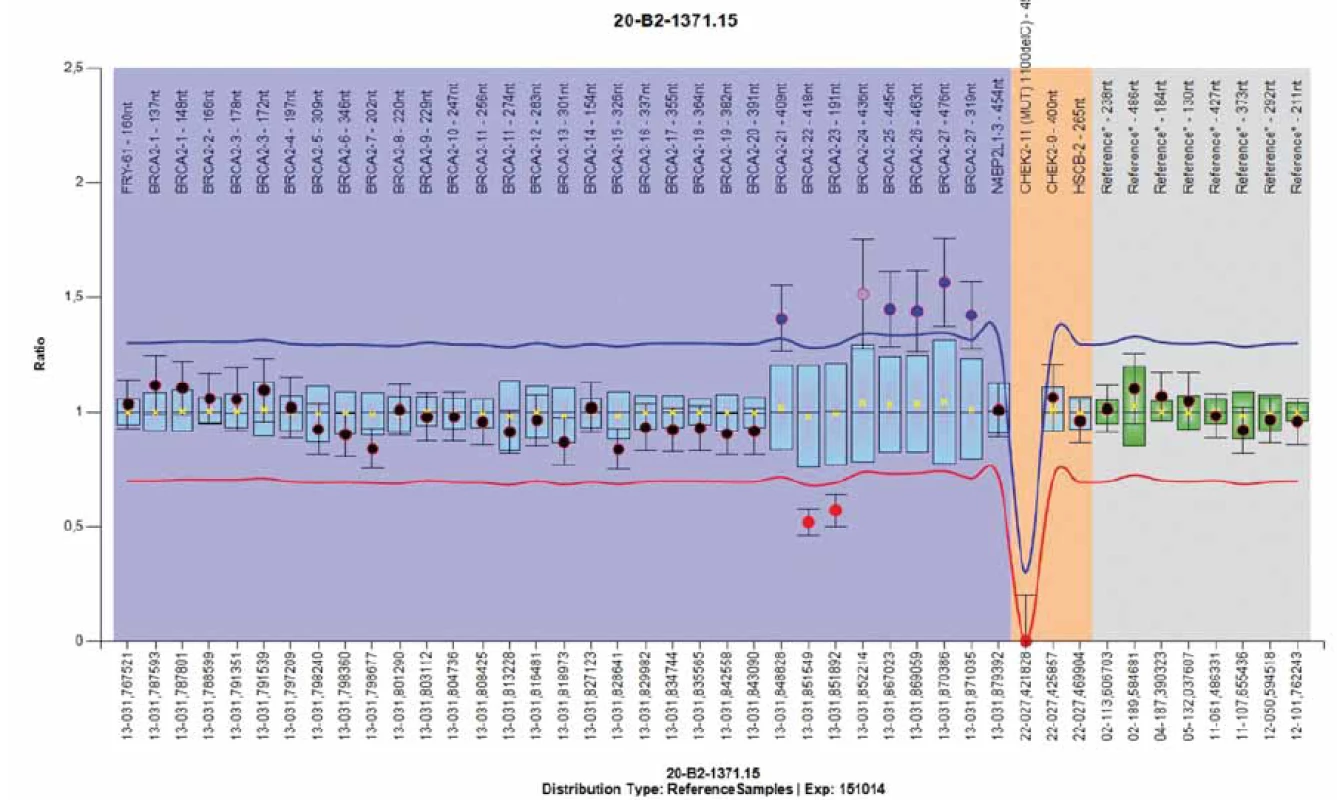 Results of Multiplex Ligation-dependent Probe Amplifi cation analysis using the Coff alyser software – family-96 with complex
<i>BRCA2</i> rearrangements (identical profi le detected in mother and in her son). Duplication of exon 21 and 3´end of exon 24 to exon
27 combined with deletion aff ecting the coding sequence of exons 22 and 5´end of exon 24: c.8886_9195del310 – confi rmed by polymerase
chain reaction analysis (amplifi ed with primers for exon 21.Forward and exon 24.Reverse) and Sanger sequencing. BRCA2
Probemix P045 (MRC Holland): probe 08267-L23772 of exon 24 (9455-9454 reverse GAAACGACAAAT-CCTATTAGGTCC ) corresponds
to the systematic position c.9227-9228.